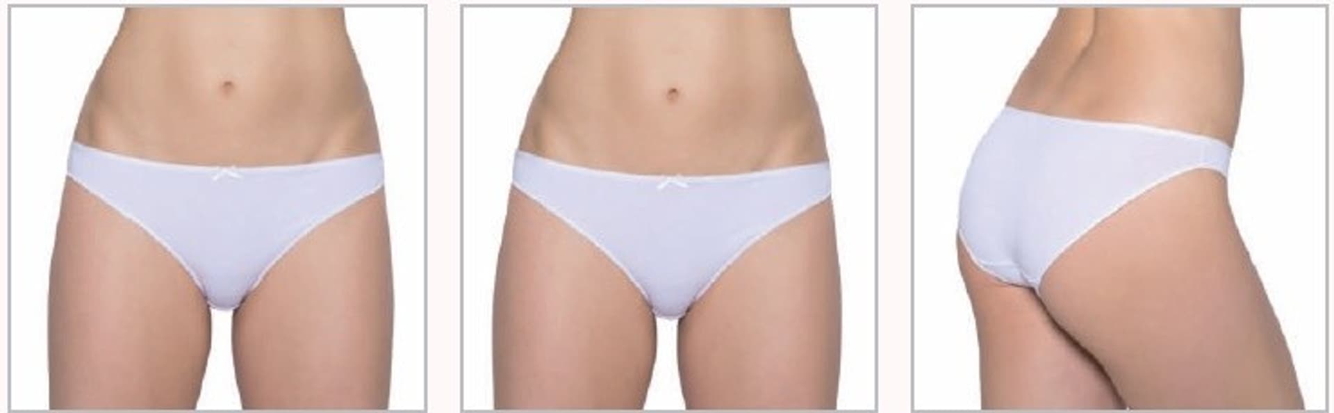 

FIGI MINI BIKINI L-400MB-01 (kolor biały, rozmiar M)