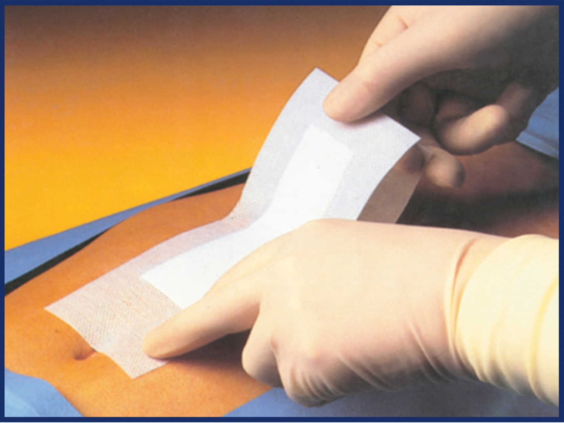 

Pharmapore Sterile-5x7cm Opatrunek samoprzylepny jałowy włókninowy