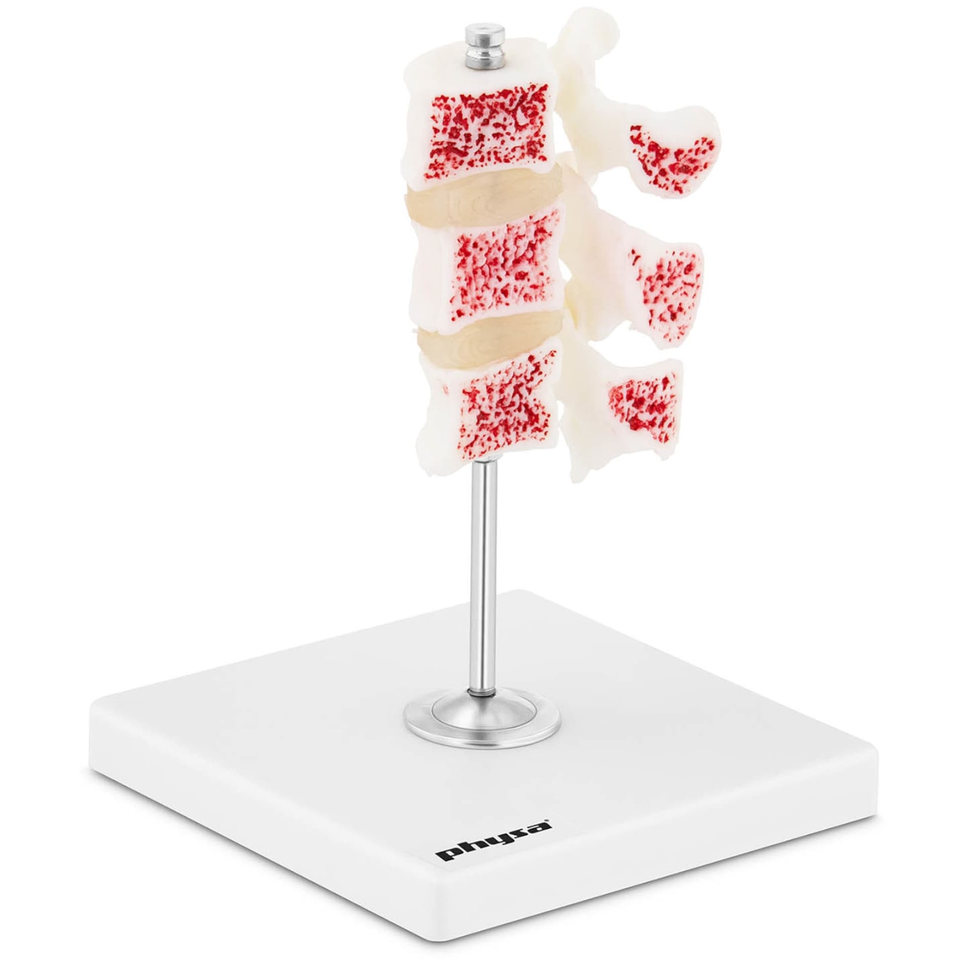 

Model anatomiczny 3D osteoporozy lędźwiowej kręgi 3-5