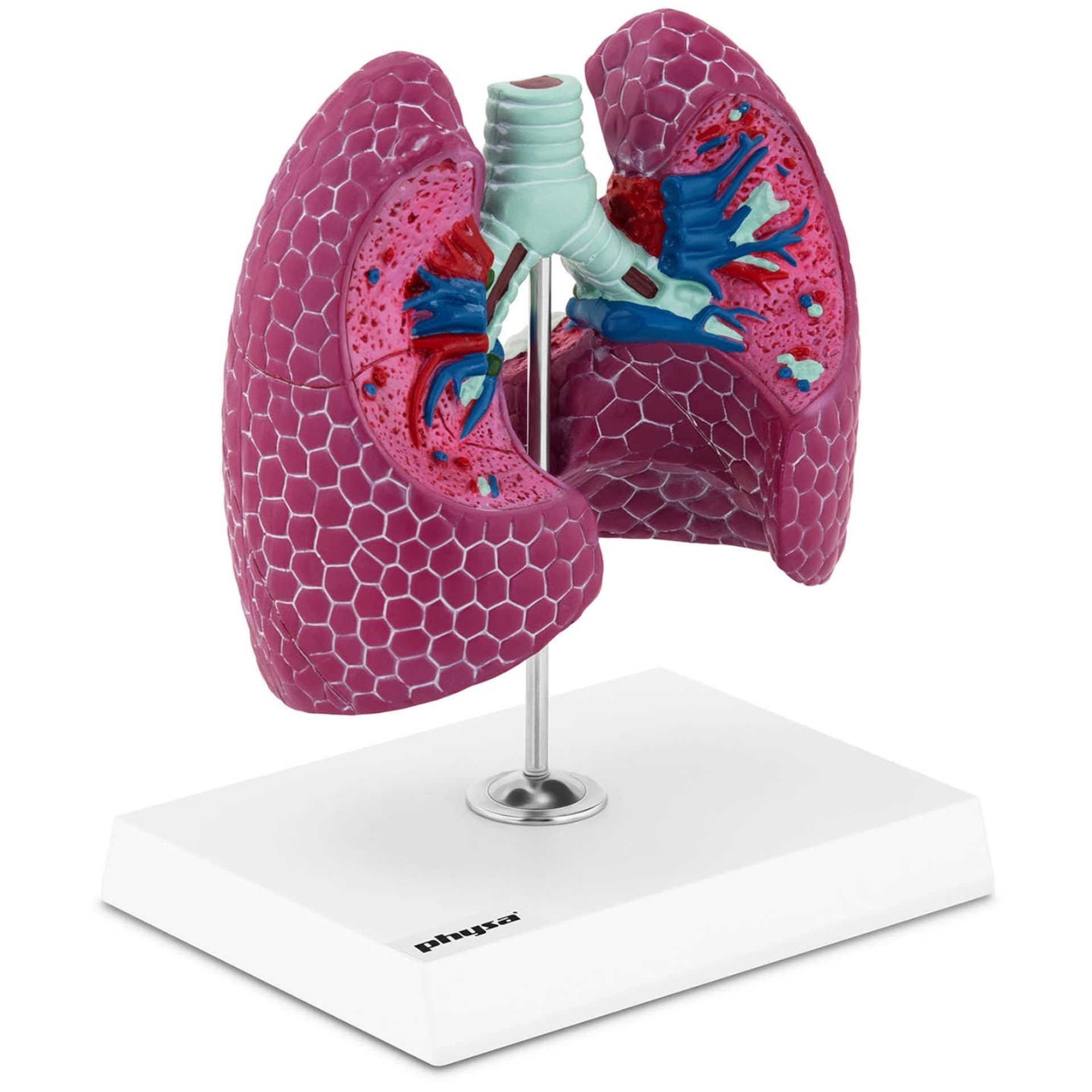 

Model anatomiczny 3D płuca człowieka ze zmianami chorobowymi