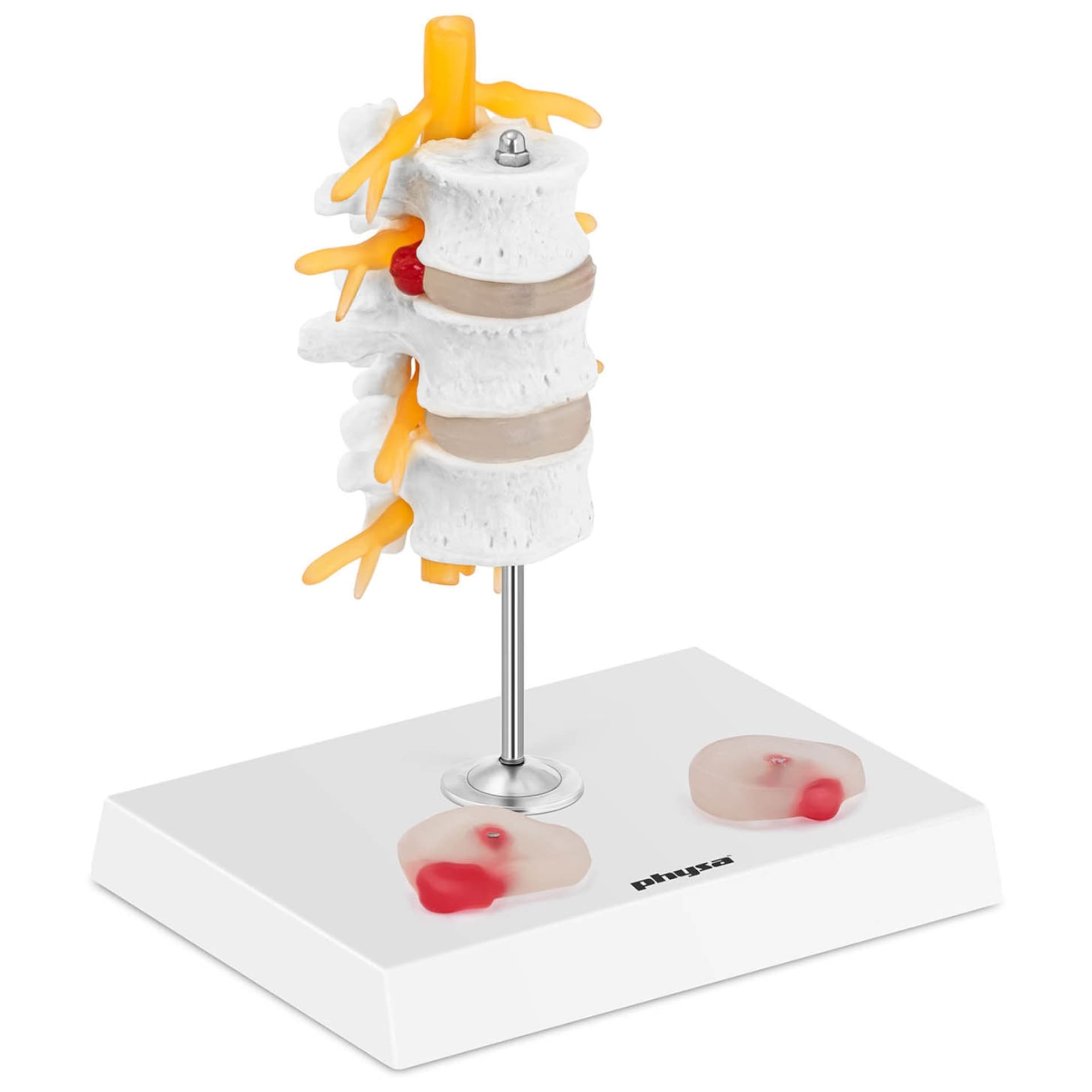 

Model anatomiczny 3D odcinka lędźwiowego kręgosłupa z przepukliną kręgi 3-5