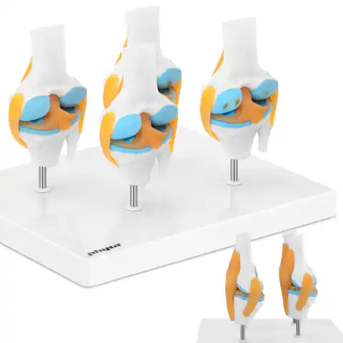 ⁨Model anatomiczny 3D stawu kolanowego ze zmianami chorobowymi 4 zmiany skala 1:2⁩ w sklepie Wasserman.eu
