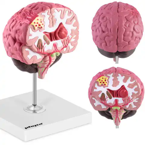 ⁨Model anatomiczny 3D mózgu ludzkiego z 3 patologiami skala 1:1⁩ w sklepie Wasserman.eu