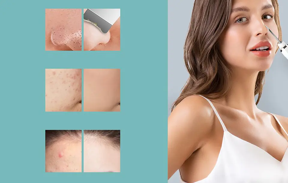 Cavitation peeling 3in1 Liberex