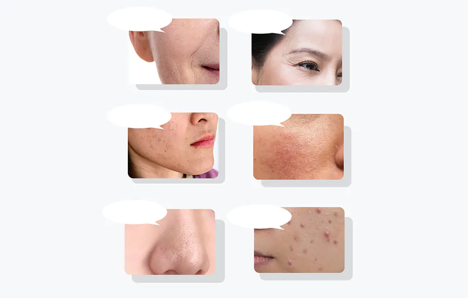 Ultrasonic facial massager with light therapy ANLAN 01-ADRY15-001