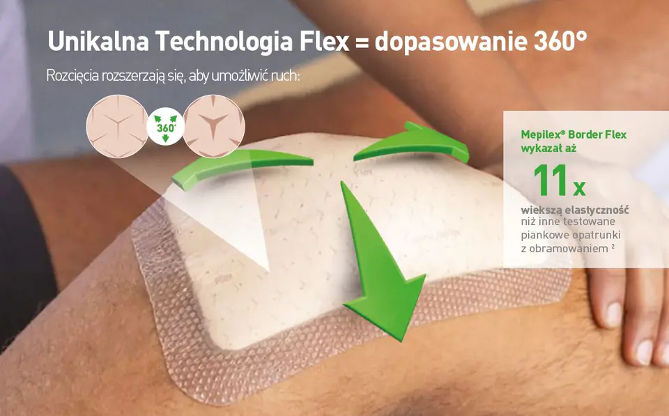 MÖLNLYCKE MEPILEX BORDER FLEX 7,5 x 7,5 cm Opatrunek chłonny piankowy, 5 szt.